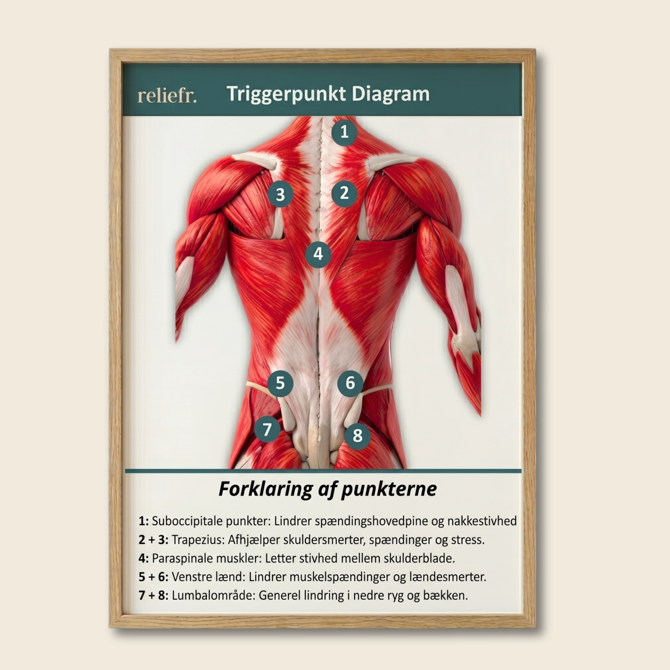 Triggerpunktdiagram